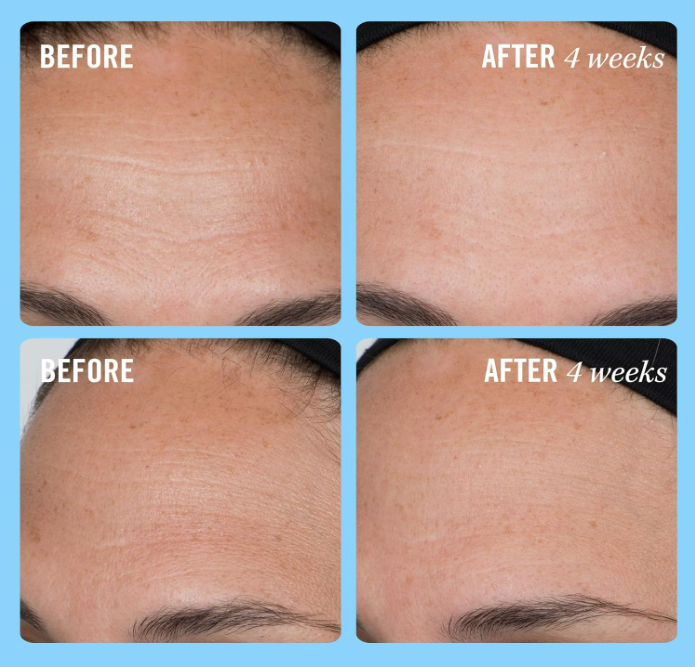 Collagen Serum