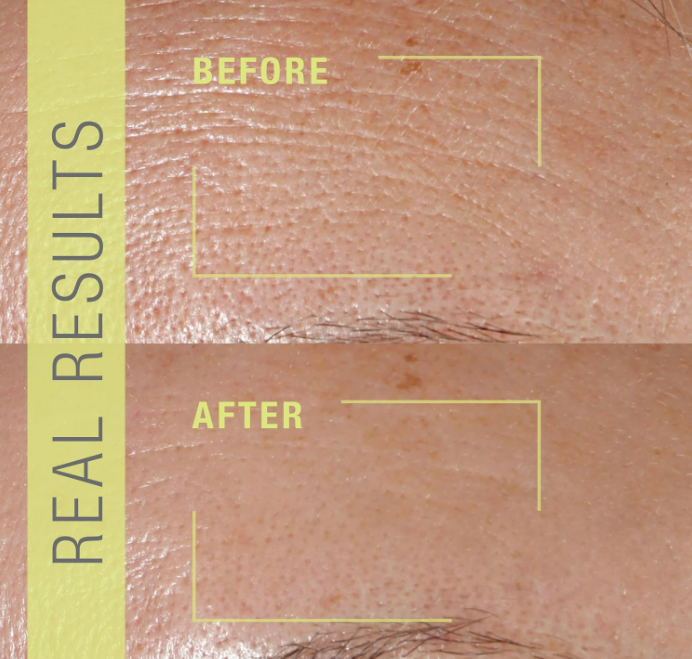 Deep Wrinkle Cream