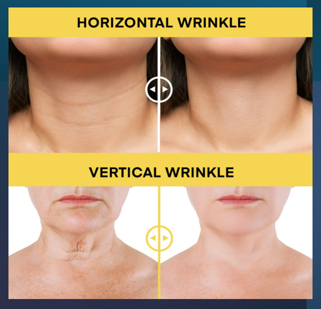 Neck Firming and Skin Tightening Cream 30ml