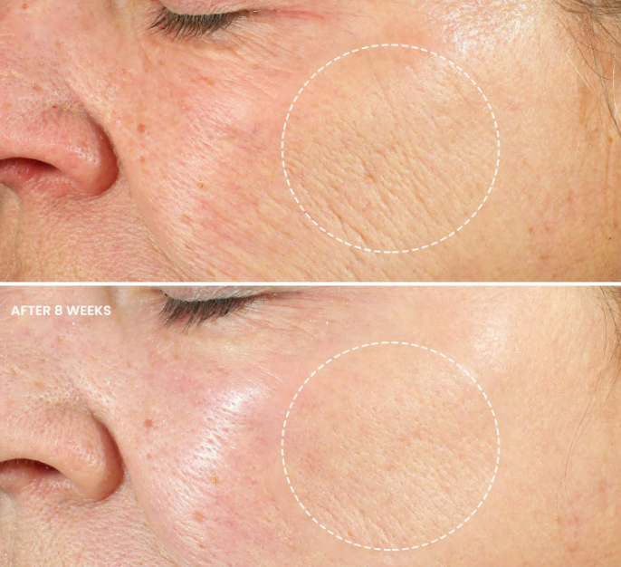 Retinol Night Moisturizer - Ella Freda Organics