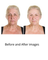 Neck Firming & Skin Tightening Cream