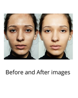 Facial Vitamin C Serum
